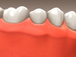 Implants - Restorative Dentistry Belmar